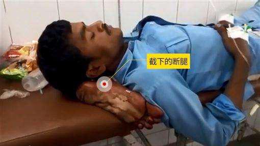 男子车祸被截肢 医院让断腿当枕头 反正闲着也是闲着
