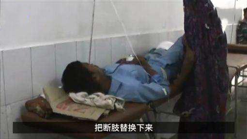 男子车祸被截肢 医院让断腿当枕头 反正闲着也是闲着