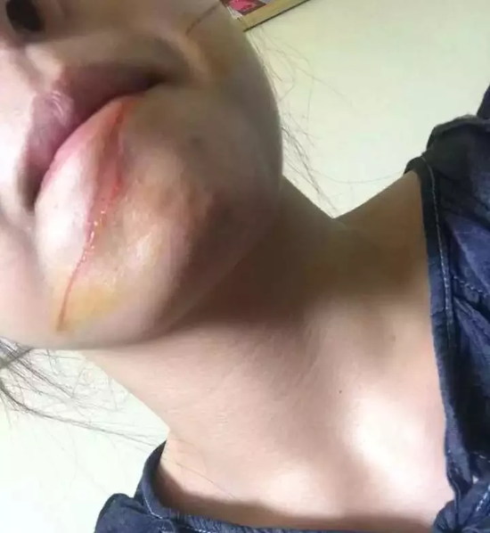 \