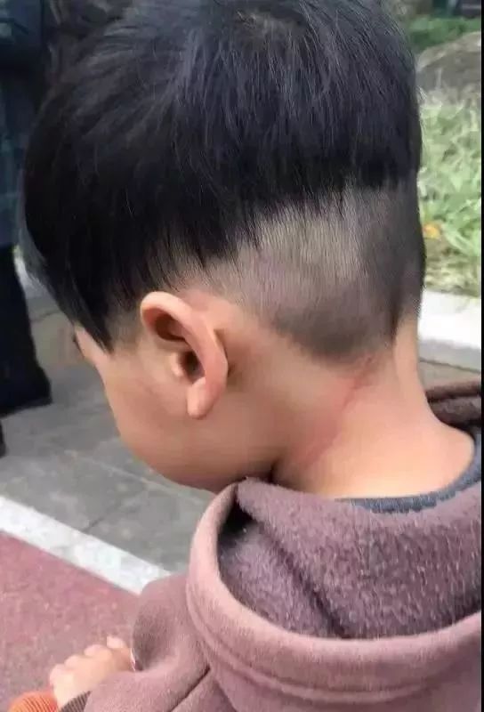 \