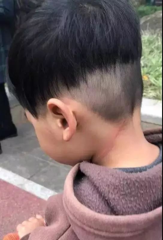 \
