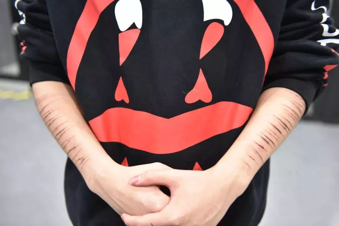 \