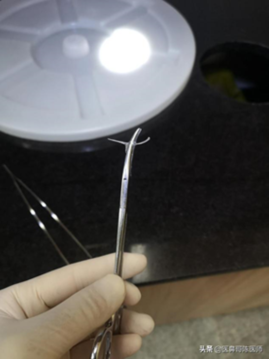 拔鱼刺被收费40元嫌贵竟投诉医生!网友怒怼:捡条命真便宜!