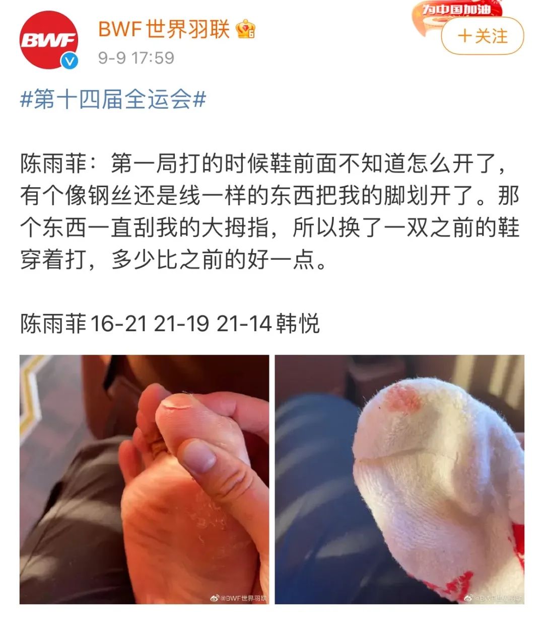 新鞋磨脚后跟怎么办 这样做就不再磨脚了_伊秀视频|yxlady.com