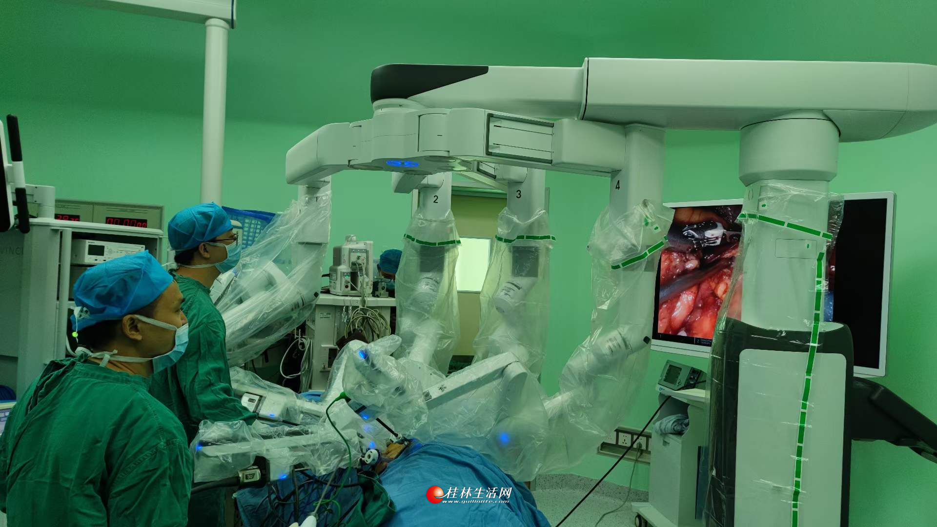 “机器人手术 ”时代来临！达芬奇Xi手术机器人深圳“首秀”